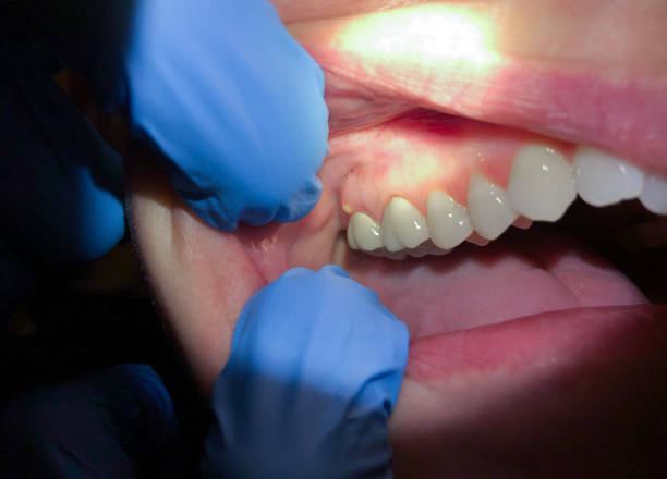 Best Urgent Dental Care for Toothache in Coyne Center, IL